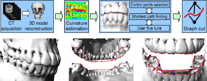Interactive approach for the lower and upper teeth
segmentation
